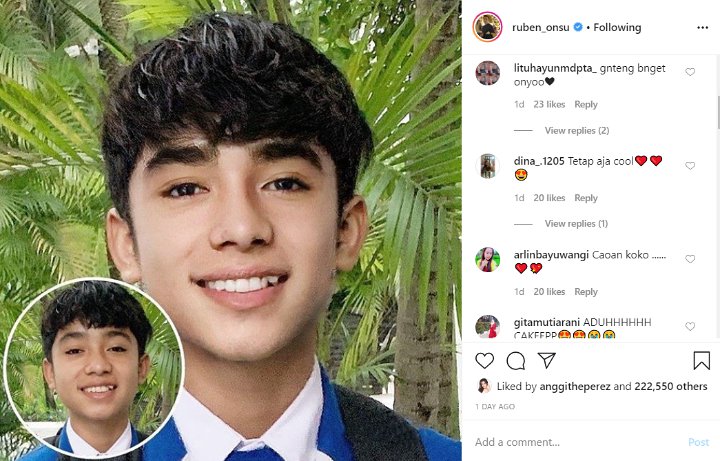 Ruben Onsu Pajang Foto Oplas Challenge Betrand Peto, Netizen Terpesona