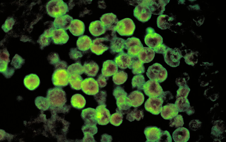AS Temukan Kasus Infeksi Ameba Mematikan Di Tengah Pandemi Corona, Peringatan Ini Dikeluarkan