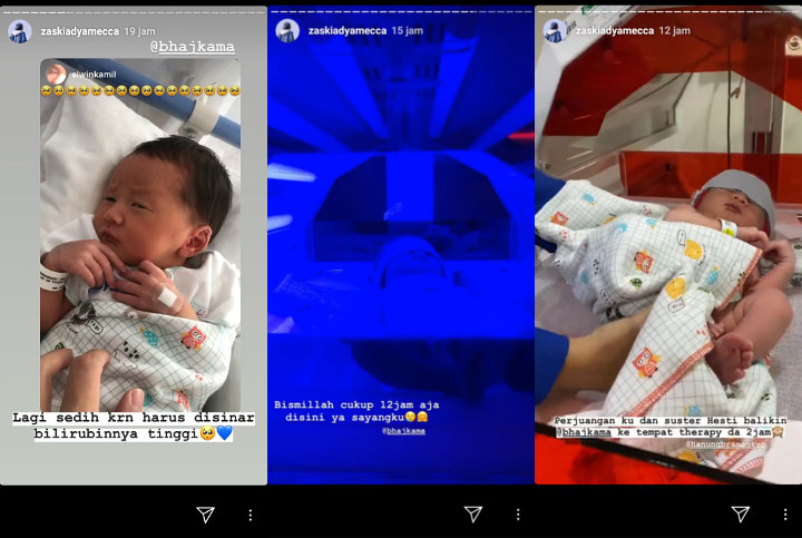 Bayi Zaskia Adya Mecca Harus Kembali Jalani Perawatan Akibat Kadar Bilirubin Tinggi