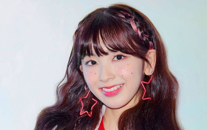 Netizen Korea Bandingkan Wajah Miihi NiziU Sebelum dan Sesudah Pakai Kawat Gigi