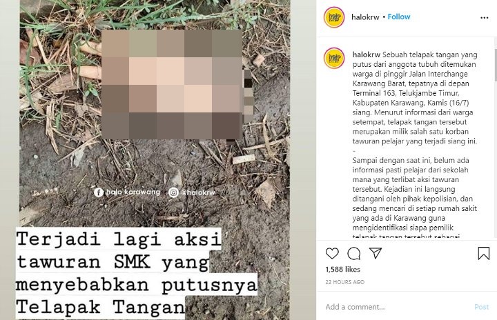 Ngeri, Tangan Pelajar SMK Tertinggal di Lokasi Tawuran Gegara Disabet Senjata Tajam