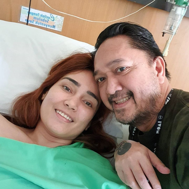Penampilan Feby Febiola Sebelum Operasi