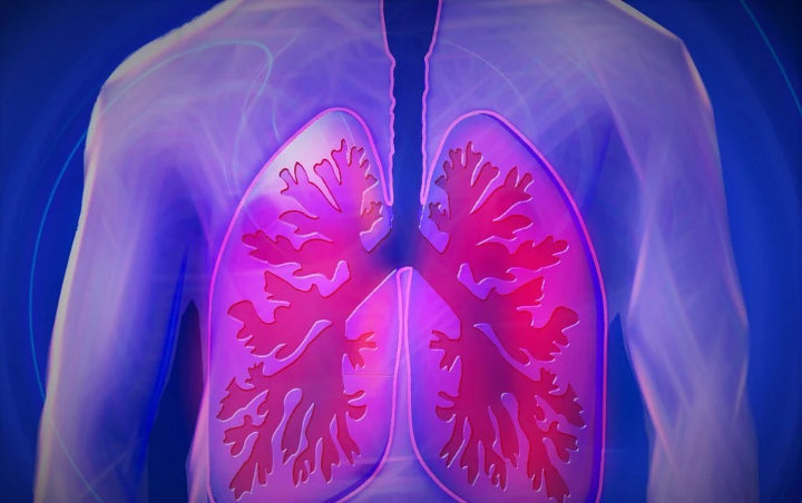 Mirip Efek Serangan Jantung, 75 Persen Pasien COVID-19 Bisa Alami Kerusakan Organ