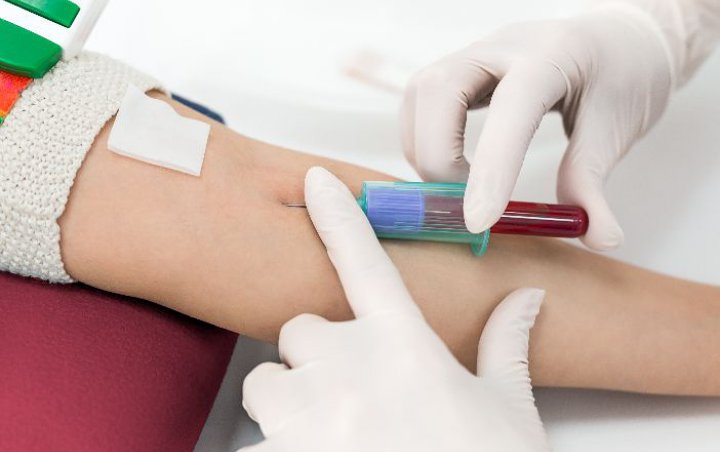 Tes Darah Disebut Bisa Tentukan Tingkat Keparahan Pasien COVID-19, Ini Faktanya