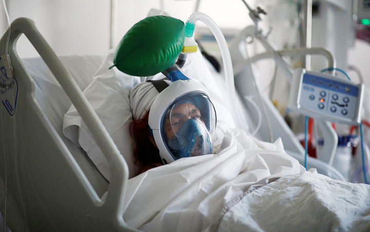 Kesaksian Soal Seberapa Mengerikannya COVID-19: Bisa Serang Organ Tubuh Berbeda di Tiap Pasien