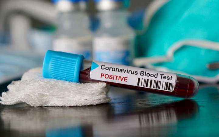 Mengejutkan, Hoaks Virus Corona Sebabkan 800 Orang Meninggal