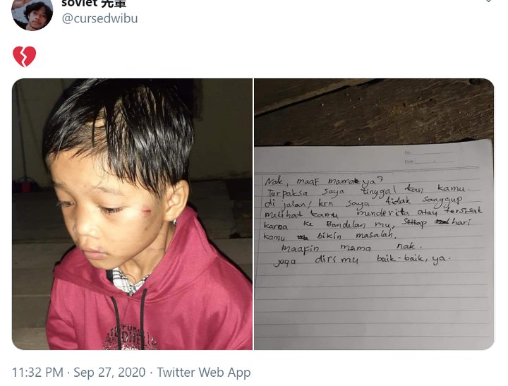 Disebut Nakal-Suka Mencuri, Bocah 8 Tahun Ini Dianiaya dan Dibuang Orangtuanya