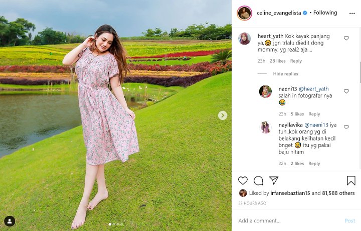 Penampilan Celine Evangelista Pakai Daster Dinilai Aneh, Diduga Kebanyakan Editan