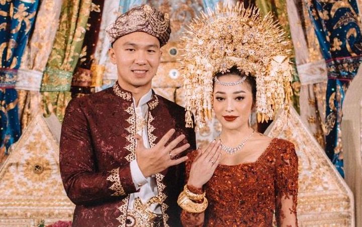 Resmi Jadi Suami Nikita Willy, Indra Priawan Dapat Hadiah Gelar Kehormatan