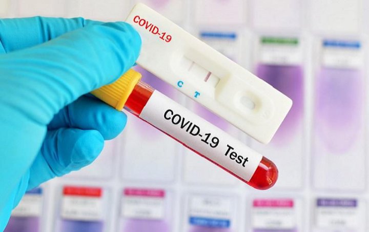 Ratusan Orang di Australia Berisiko Tertular HIV/AIDS Saat Jalani Tes COVID-19, Kok Bisa?
