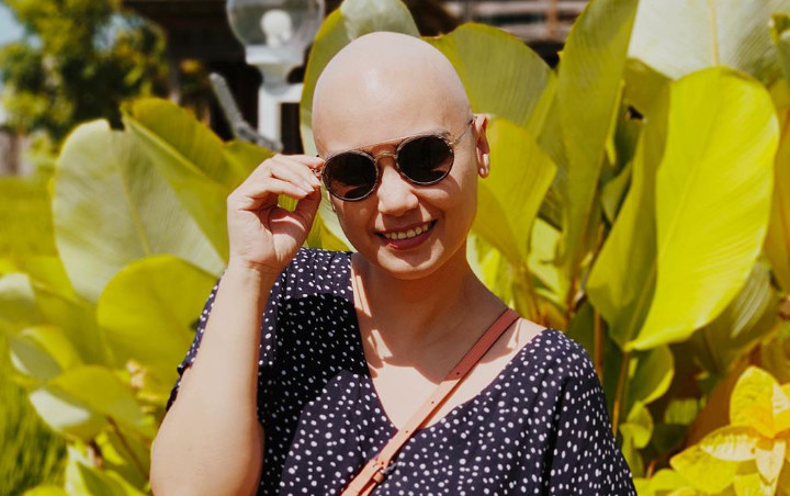 Jalani Kemoterapi Terakhir, Feby Febiola Mulai Kangen Punya Rambut Panjang