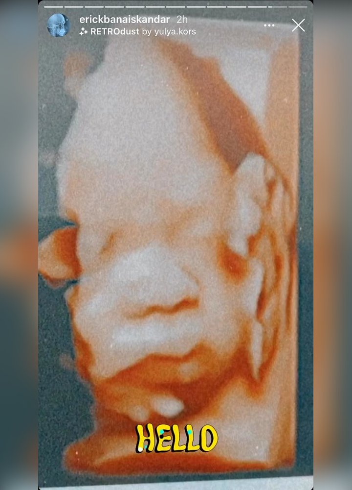 Bikin Heboh, Erick Iskandar Kepergok Antar Pacar ke Dokter Kandungan Sampai Pamer Hasil USG