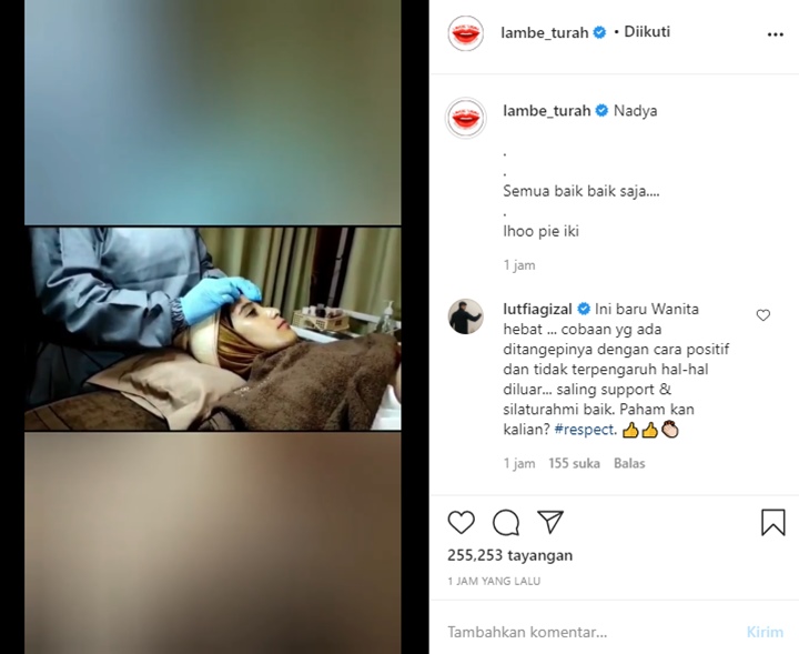 Istri Rizki DA Tolak Jawab Pertanyaan Soal Kehamilan, Lutfi Agizal Puji Wanita Hebat