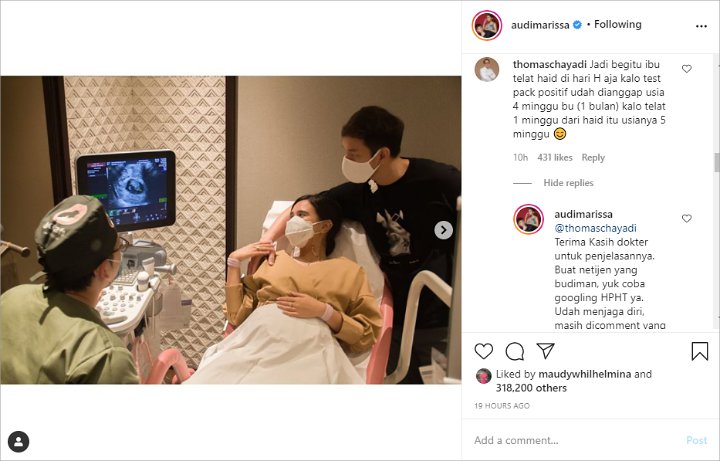 Balasan Cerdas Audi Marissa Saat Dituding Hamil Diluar Nikah, Dokter Kandungan Sampai Buka Suara