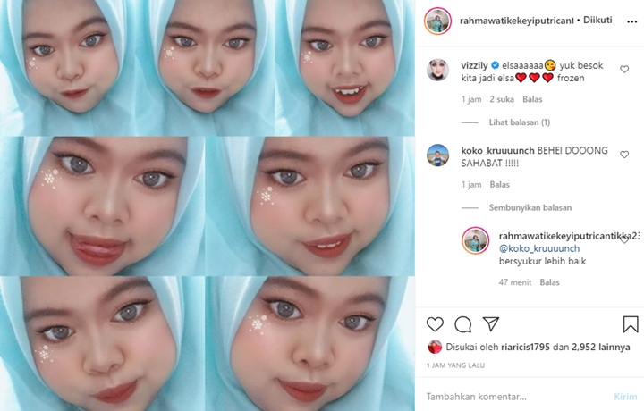 Rahmawati Kekeyi Beri Jawaban Bijak Saat Diminta Behel Gigi, Rencana Jadi Princess Elsa Terungkap