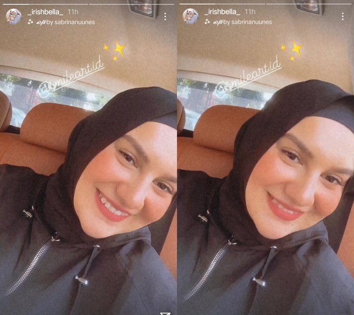 Irish Bella Akhirnya Pamer Penampilan Baru Pakai Behel Usai Drama Gigi Gingsul, Makin Cantik?