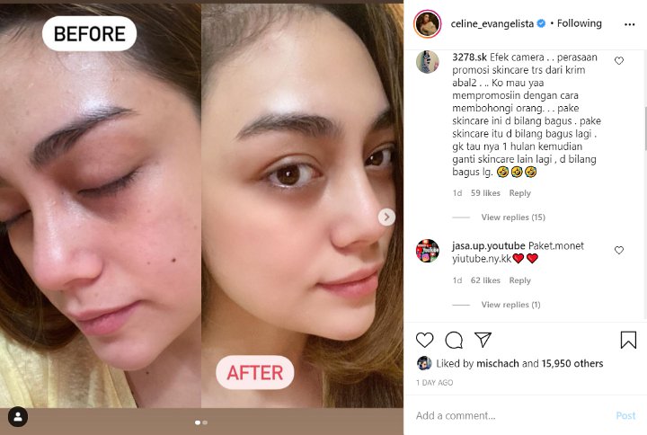 Endorse Skincare, Celine Evangelista Dituding Lakukan Pembohongan Publik