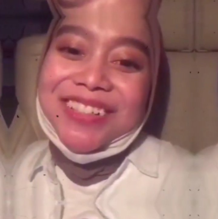 Meggy Wulandari Sahkan Pernikahan, Lesty Kejora Putuskan Cabut Gigi Gingsul - Topik Pagi