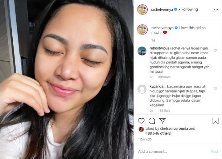 Rachel Vennya Masih Didukung Meski Putuskan Lepas Hijab, Netter Prihatin dengan Rina Nose