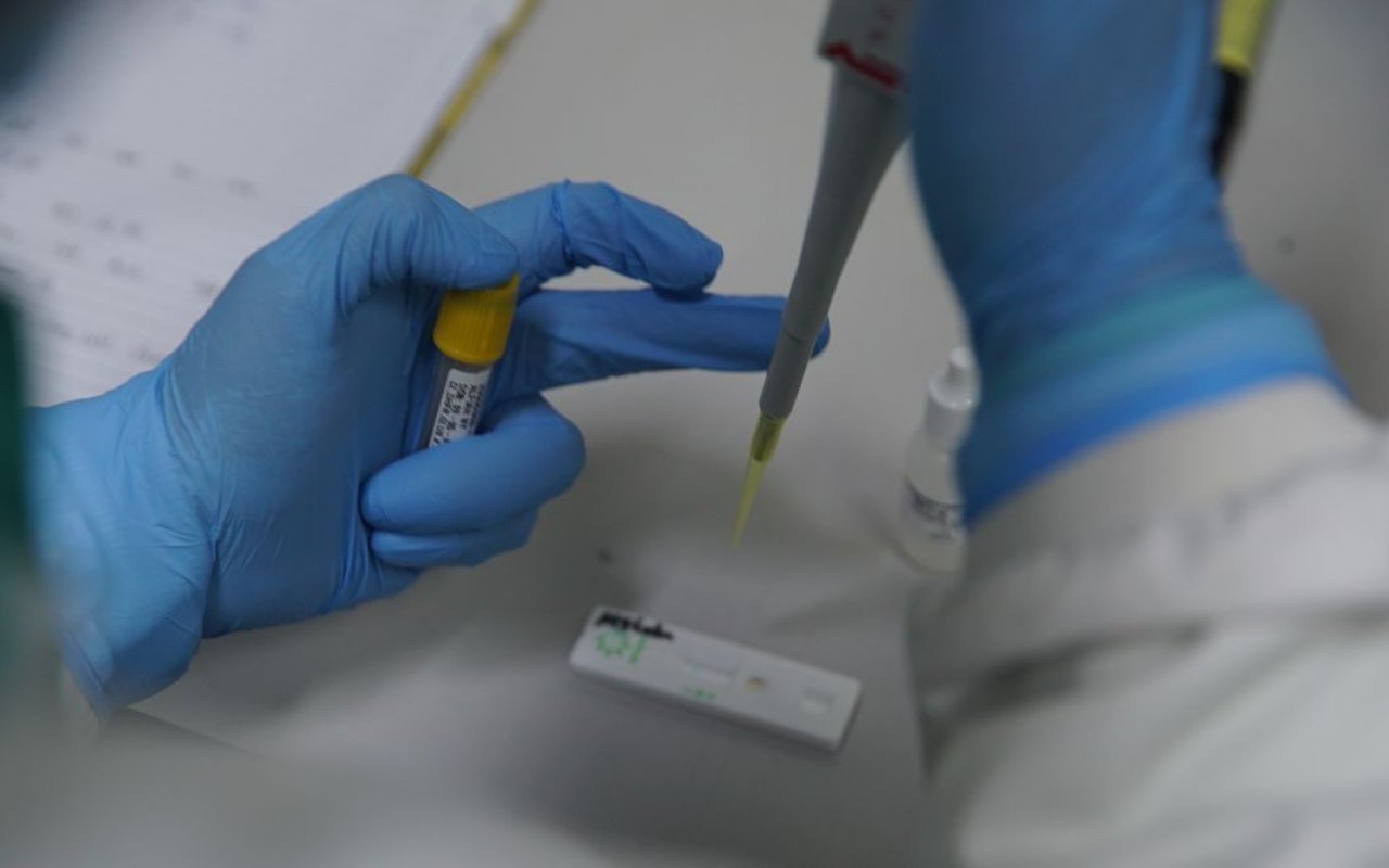 'Dikejar' Target Pemerintah, BPOM Diminta Independen soal Uji Vaksin Corona