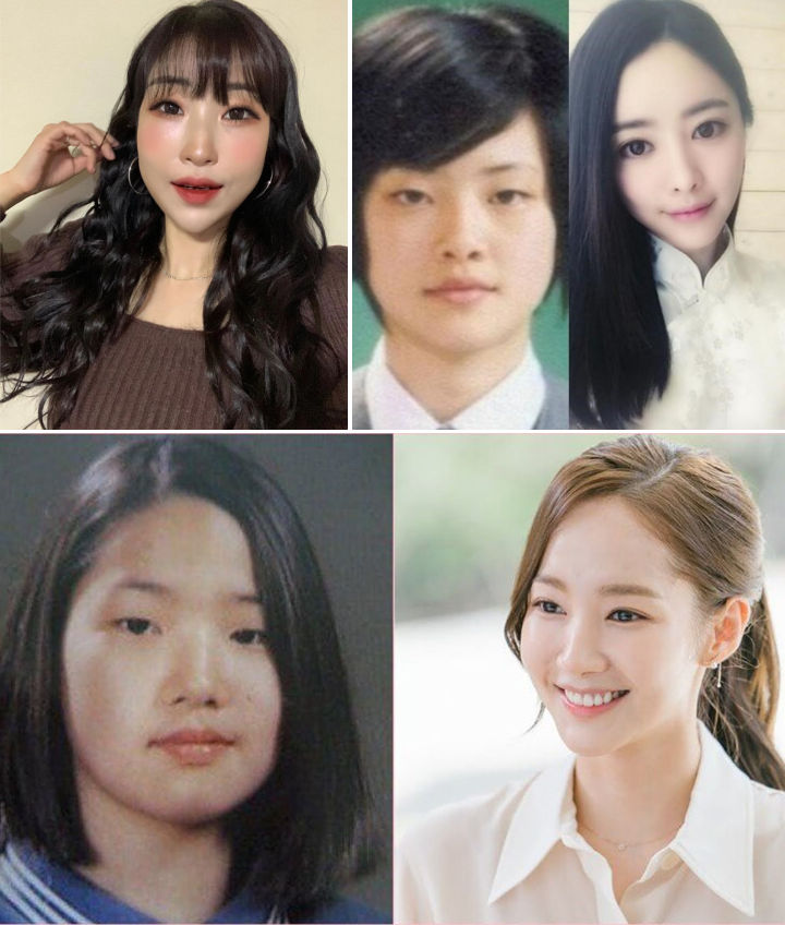 6 Selebriti Wanita Ini Terang-Terangan Akui Jalani Operasi Plastik