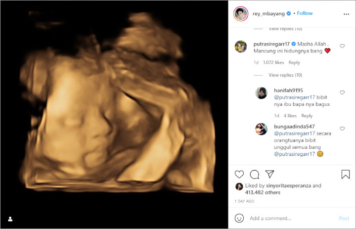 Hidung Mancung Calon Bayi Dinda Hauw dan Rey Mbayang Jadi Perbincangan