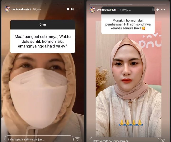Sempat Suntik Horman Laki-Laki, Evelin Nada Anjani Kini Beri Penjelasan Soal Jadi Wanita Seutuhnya