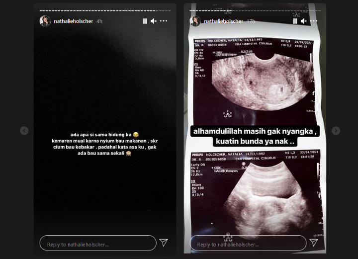 Hamil 5 Minggu, Nathalie Holscher Mendadak Ngeluh Gara-gara Rasakan Hal Aneh
