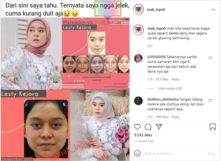 Bikin Pangling, Metamorfosis Wajah Lesty Kejora Malah Disindir Karena Banyak Duit