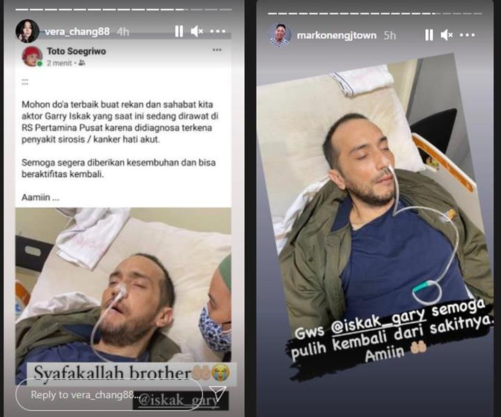 Gary Iskak Derita Kanker Hati
