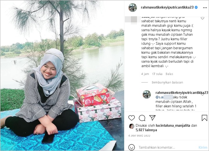 Disebut Ubah Ciptaan Tuhan Usai Lakukan Filler Hidung, Rahmawati Kekeyi Beri Penjelasan: Smart Baby