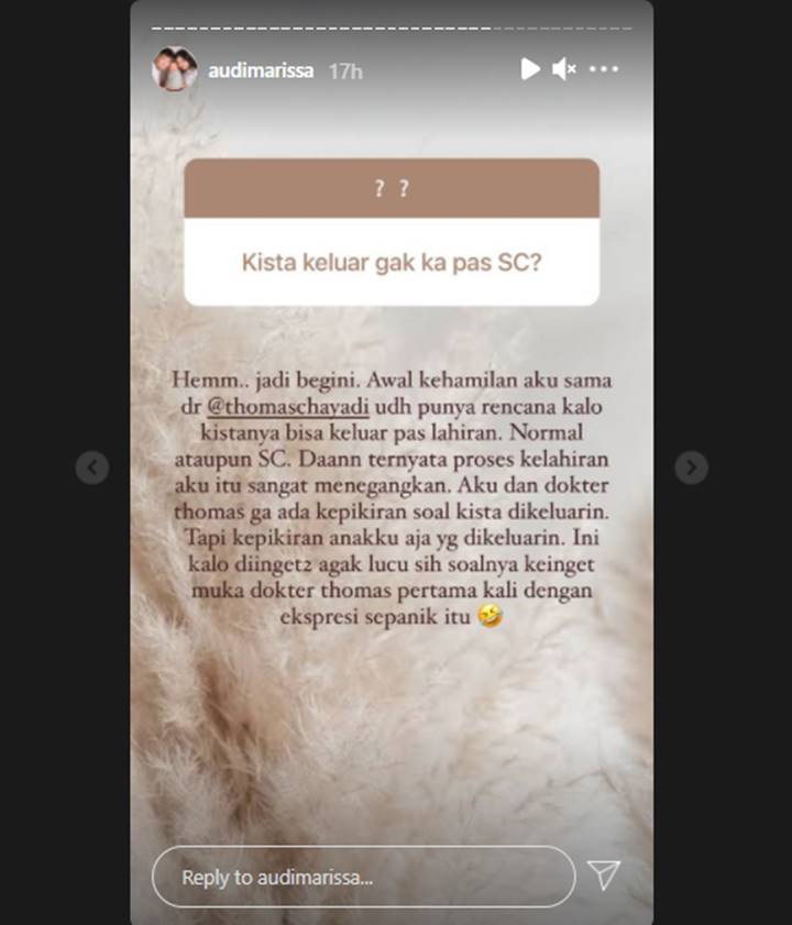 Cerita \'Kocak\' Audi Marissa Gagal Keluarkan Kista Gara-gara Situasi Tegang Saat Persalinan