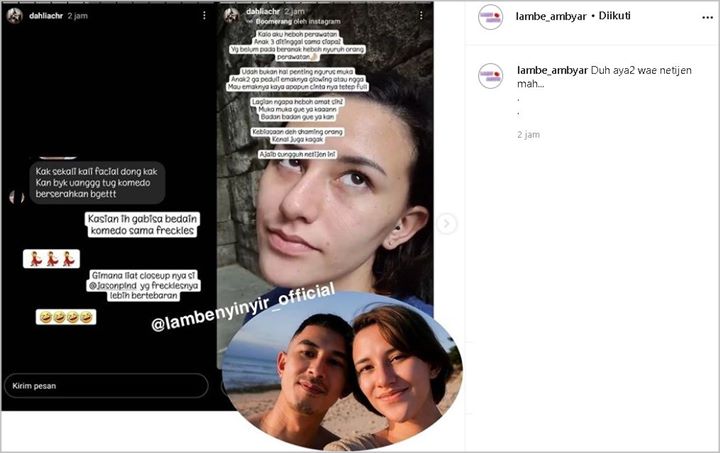 Dahlia Poland Skakmat Netter Julid Soal Komedo Hingga Diminta Perawatan, Kecantikan Natural Disorot