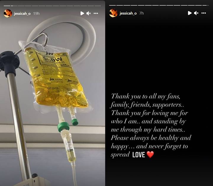 Bikin Khawatir, Jessi Beri Pesan Manis Usai Update Foto Diinfus di Rumah Sakit