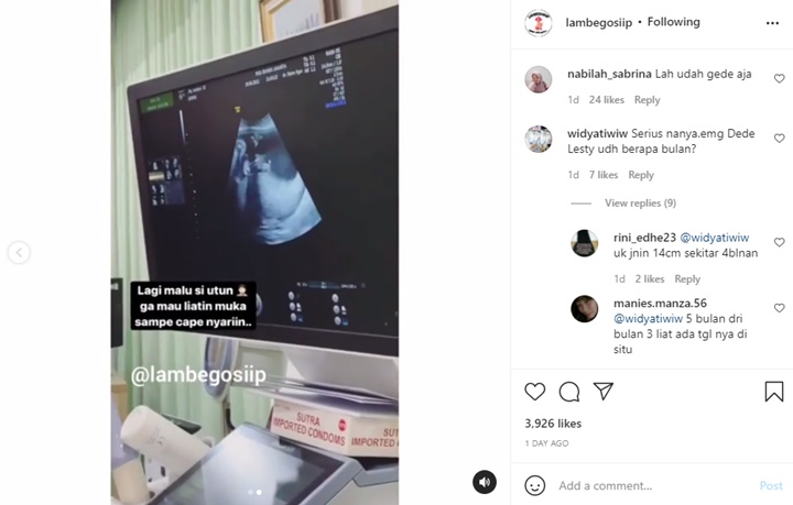 Usia Kandungan Lesty Kejora Akhirnya Terungkap, Netizen Temukan Beberapa Bukti Valid