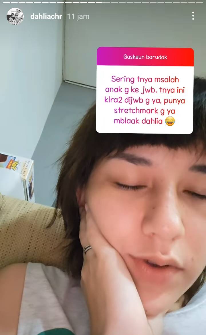 Dahlia Poland Santai Punya Stretch Mark: Kenang-kenangan Pernah Hamil