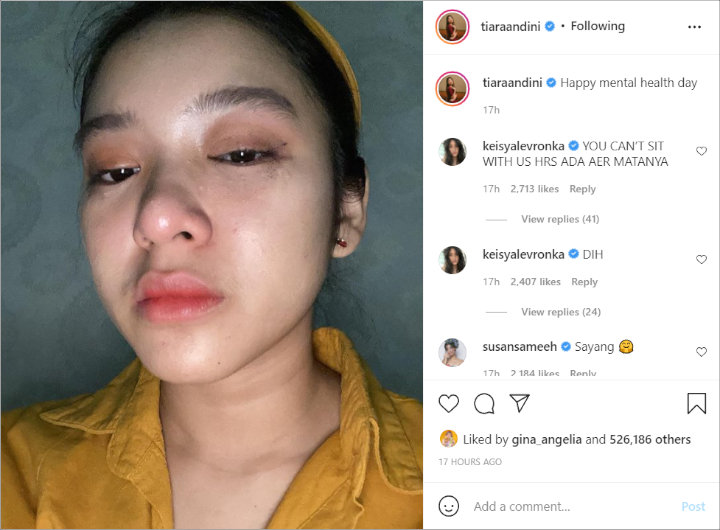 Tiara Andini Bagikan Potret Wajah Sembap Habis Nangis: Aku Juga Manusia