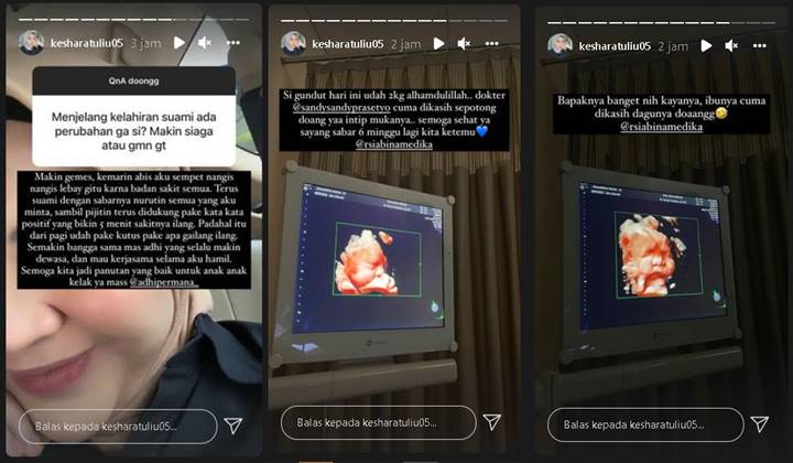 Jelang Melahirkan Anak Pertama, Kesha Ratuliu Curhat Perubahan Perilaku Suami: Makin Gemes