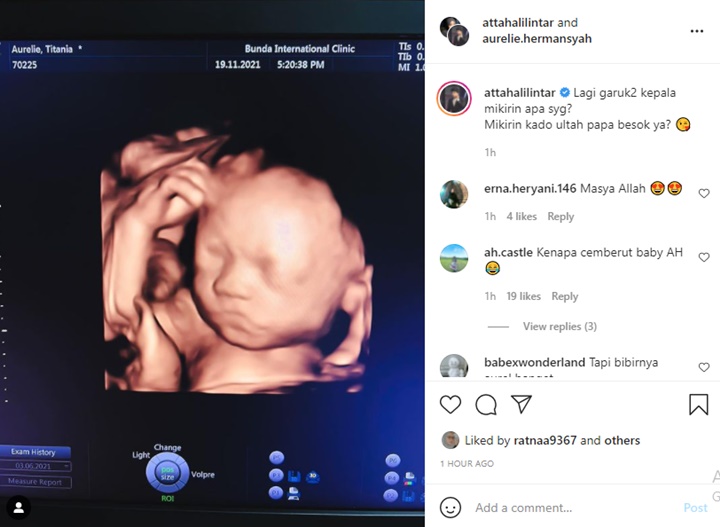 Lucunya Calon Bayi Aurel Hermansyah Garuk-garuk Kepala, Atta Halilintar Tebak Karena Ini