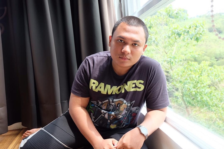 Imut Dengan Rambut Plontos