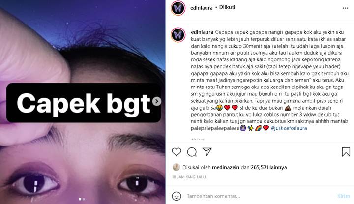 Tengah Perjuangkan Keadilan, Laura Anna Justru Balas Minta Maaf Saat Kelumpuhannya Dihina Netizen
