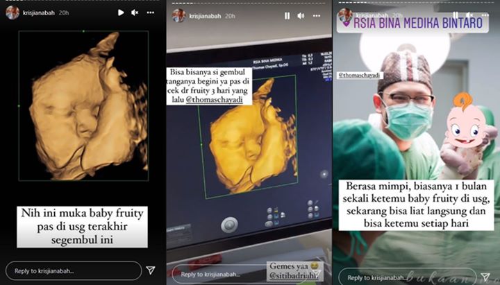 Anak Siti Badriah dan Krisjiana Baharudin Acungkan Jari Tengah Saat Foto USG Terakhir Bikin Ngakak