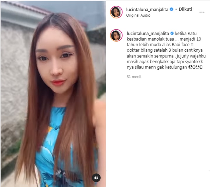 Belum Final, Lucinta Luna Sebut Dalam 3 Bulan Wajahnya Akan Jadi 10 Tahun Lebih Muda