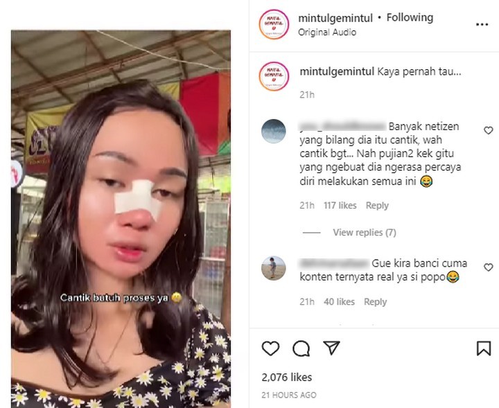 Popo Barbie Nekat Oplas Demi Tampil Cantik?