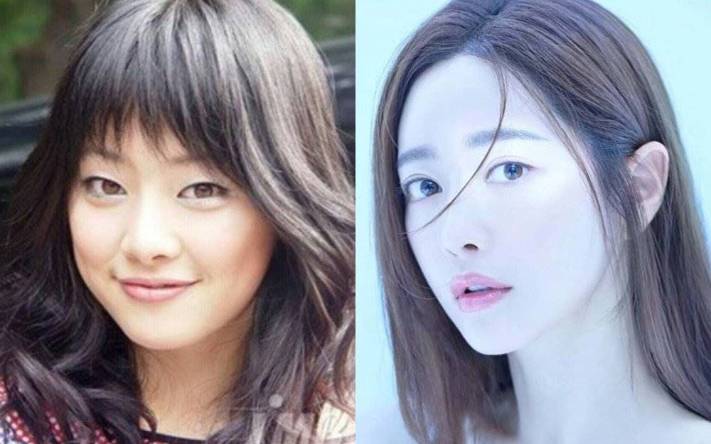 Potret Hong Soo Ah sebelum dan sesudah operasi plastik