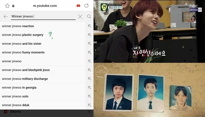 Kim Jin Woo WINNER Dikira Oplas Hidung karena Terlalu Ganteng, Inikah Fakta Sebenarnya?