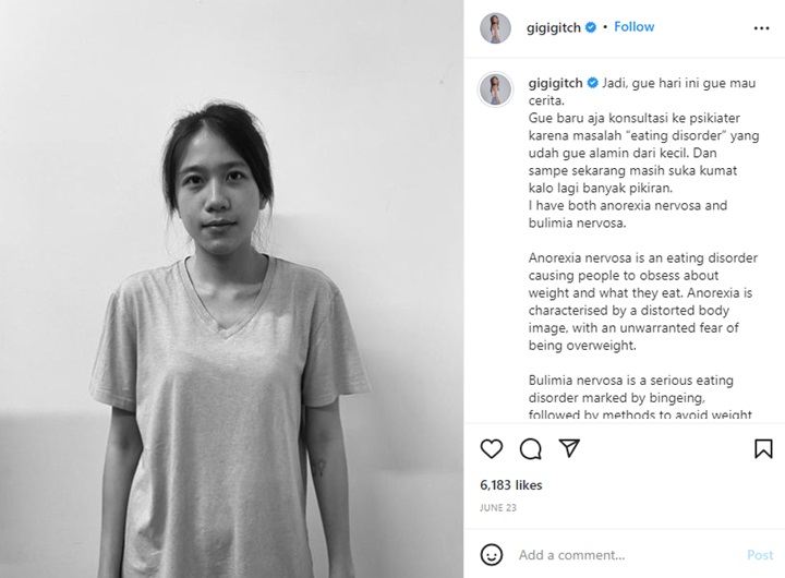 Gigi Eks Cherybelle Ungkap Kondisi Terkini Usai Kabarkan Idap Anoreksia, Ada Kemajuan?