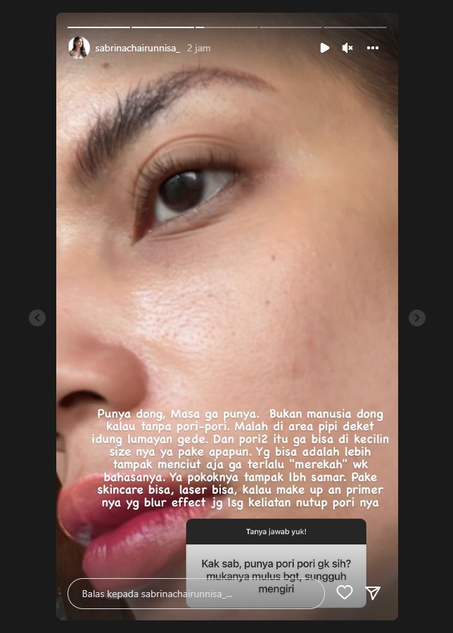 Kerap Tampil Cantik dan Mulus, Sabrina Chairunnisa Bagikan Foto Wajahnya yang Tak Sempurna