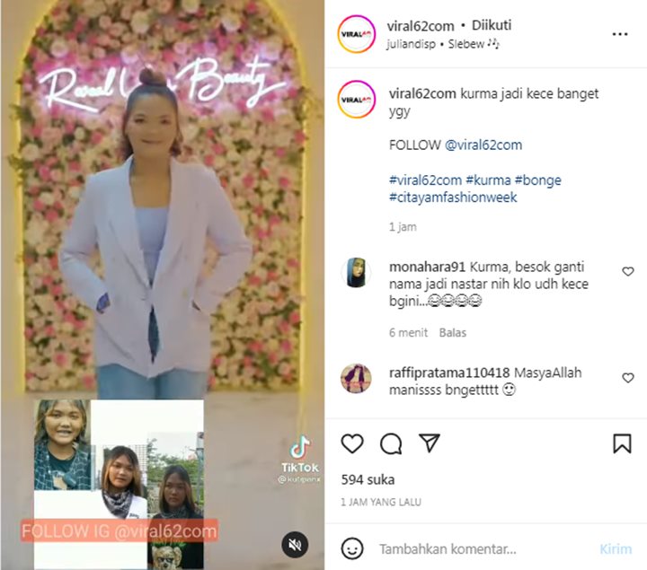 Kurma Citayam Fashion Week Jalani Perawatan, Penampilan Terbarunya Bikin Takjub