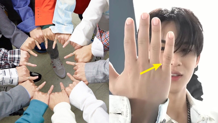 Mingyu Ungkap Kondisi Mengkhawatirkan Jari Kelingkingnya Karena Cincin SEVENTEEN